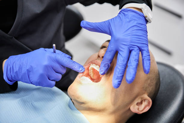 Best Emergency Tooth Extraction in Hydro, OK